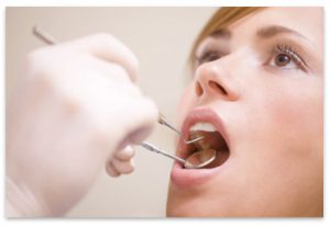 Dental Checkups