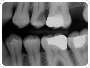 Dentist X-Ray