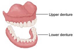 full dentures
