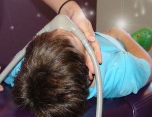 sedation nitrous
