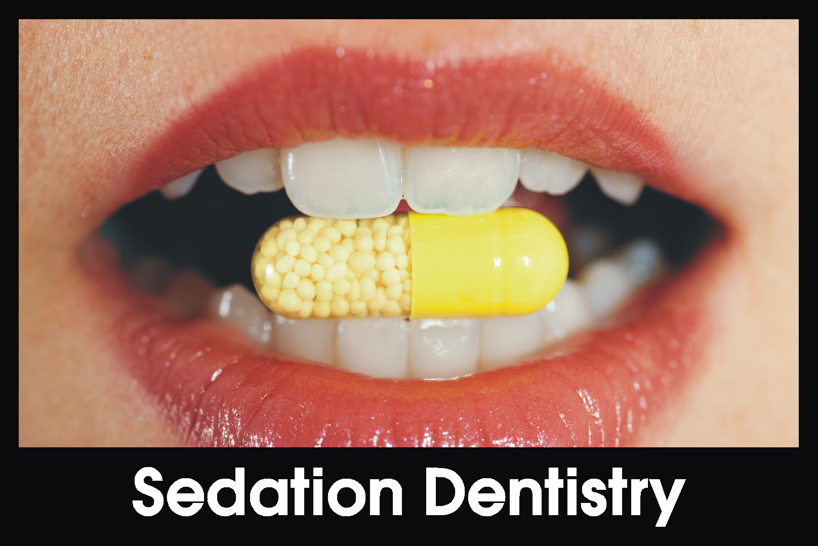 Sedation Dentistry